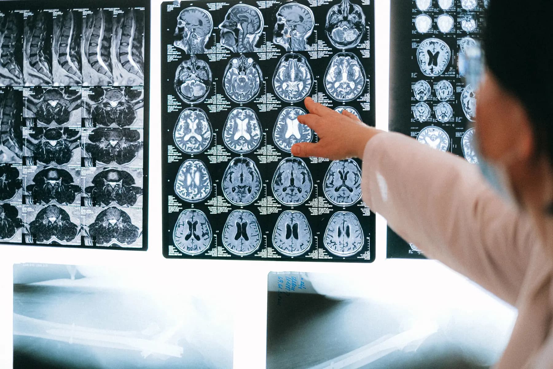 Specialist reviewing brain MRI scans